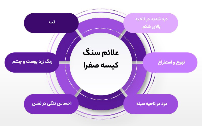 مهم ترین علایم و نشانه های سنگ کیسه صفرا - بیمارستان تندیس تهران