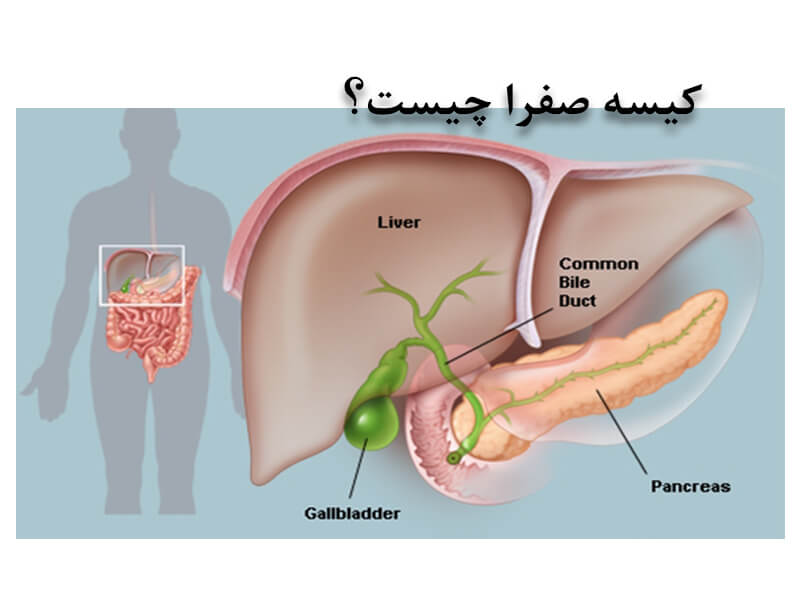 کیسه صفرا چیست؟