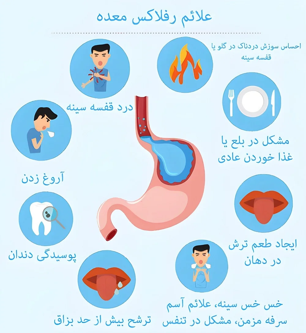 علائم رفلاکس معده