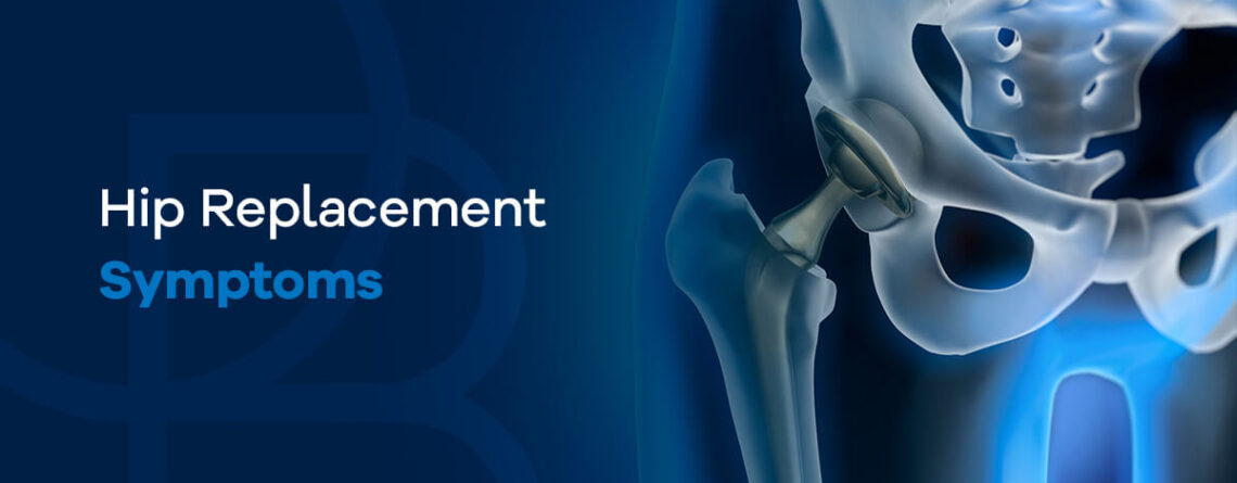 Hip replacement